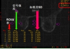 图像信噪比(signal-to-noise ratio,SNR)的测量及要求