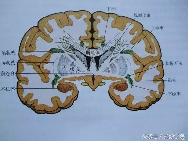 23ddf3cf7890c1b3832b0a8d7337954b.jpg
