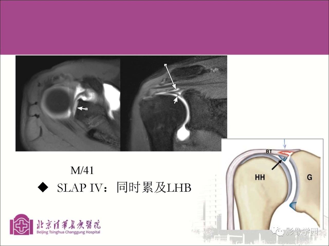 6db6a320f9dc4c27a1069529c11a7547.jpg