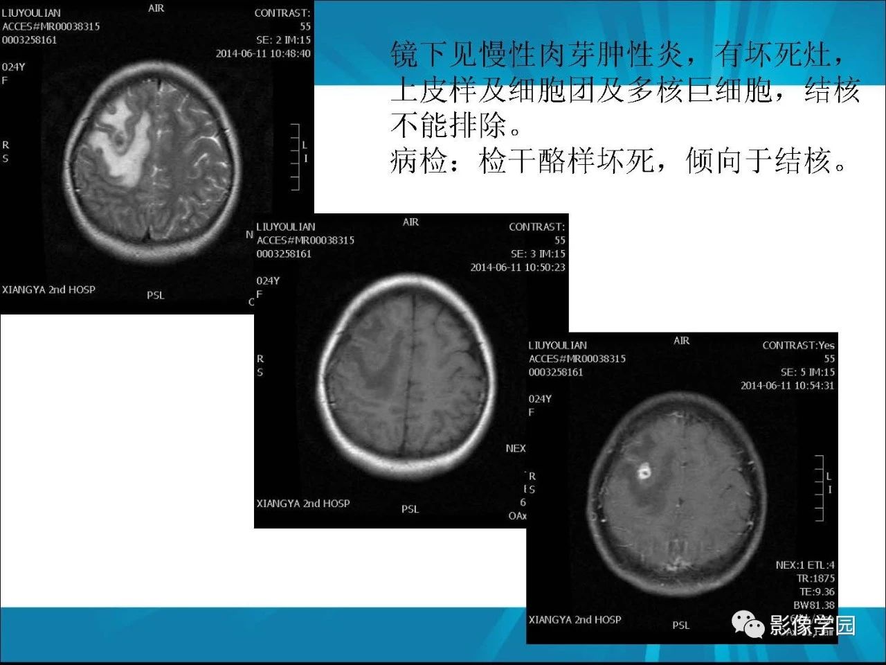 79d53a3fb85a6892136571b6c1437ded.jpg