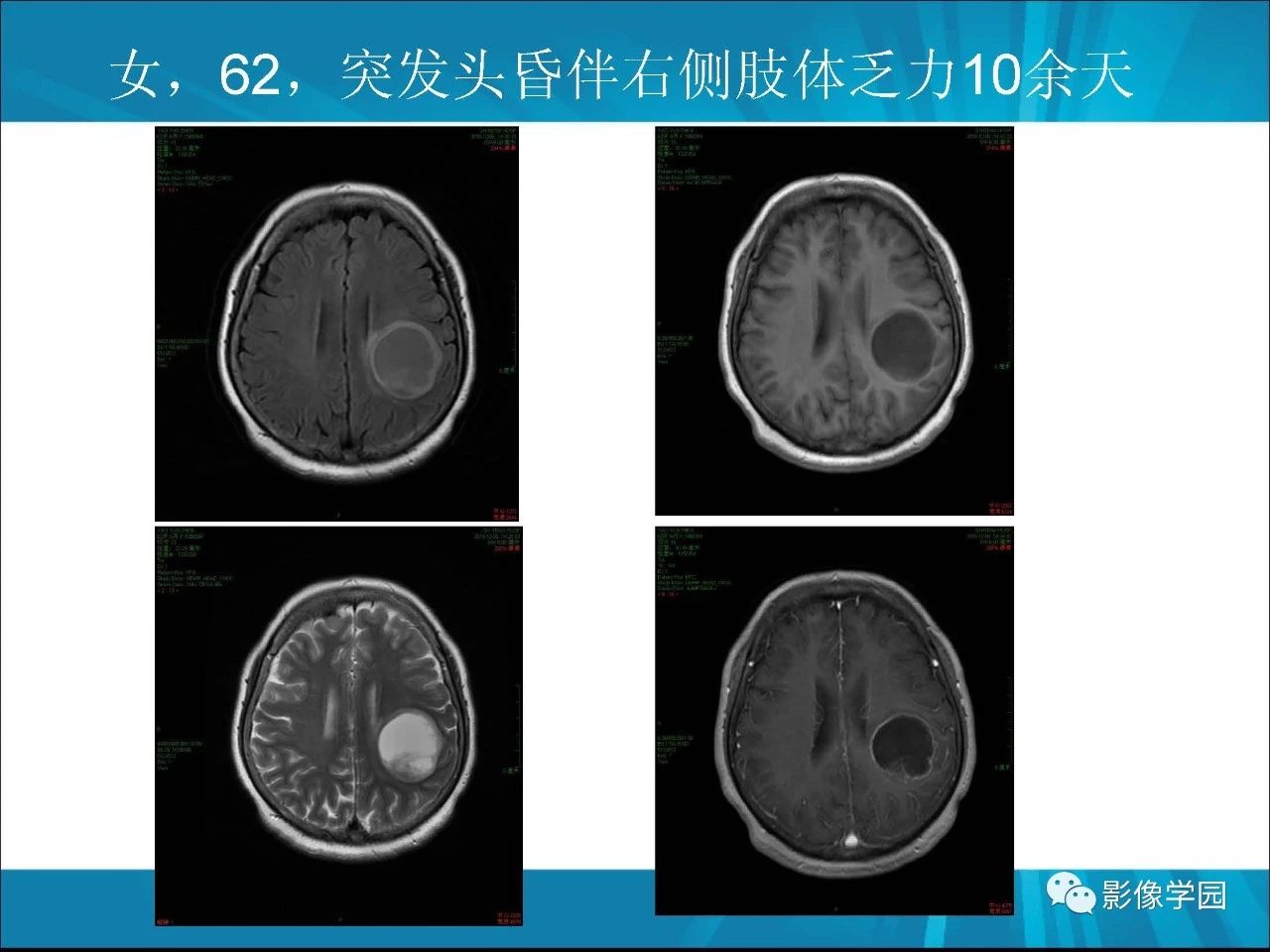 aea60d44bf4afae61f42e2f9e9e65f5d.jpg