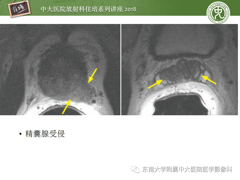 d5a5160ce59a9764bdb945143f181a50.jpg