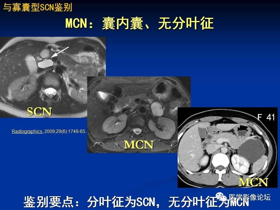 81c140f26eca595b83108b7731dd40df.jpg