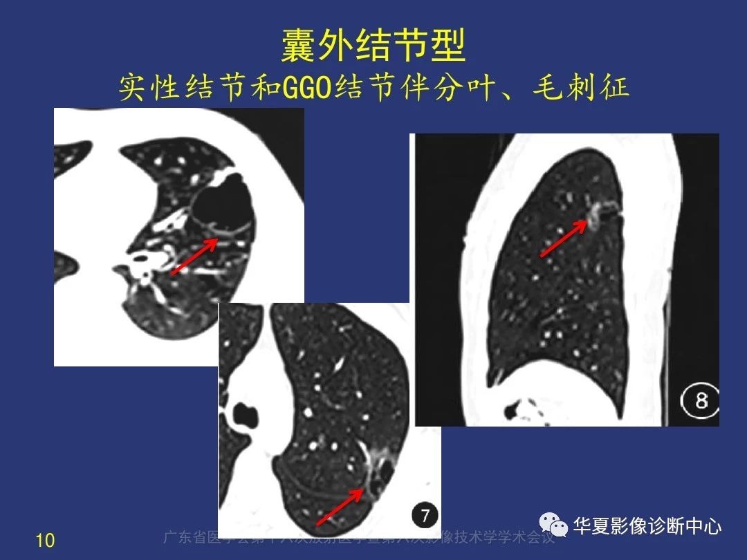 4fc02b9ab0cbd925a48327c9ea9e8ca3.jpg