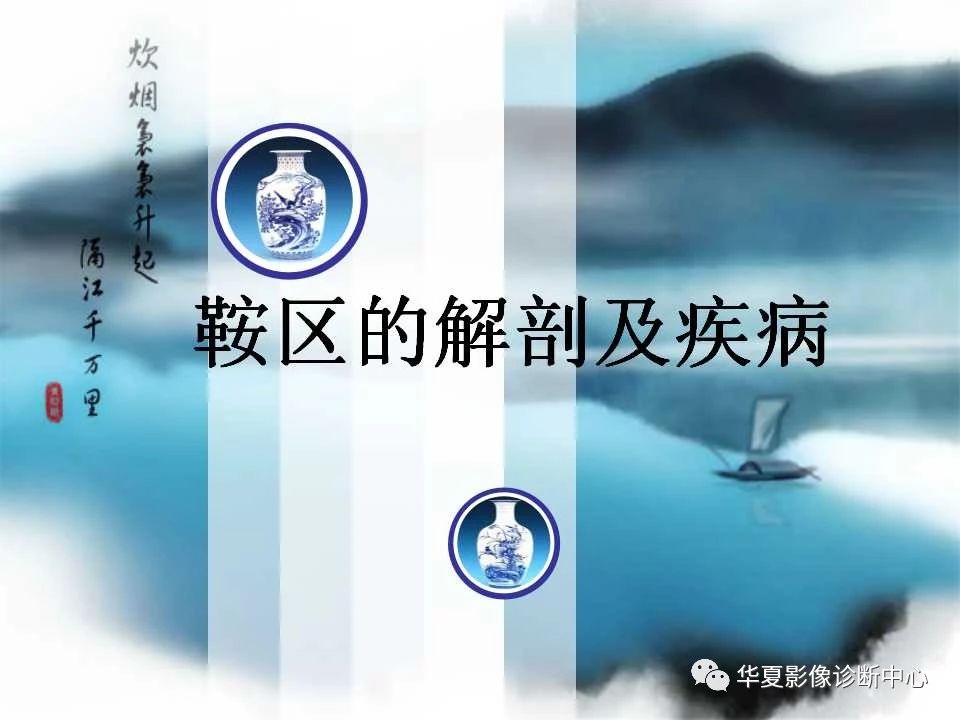 91ec19afca0169e15f9e4c02d2928b48.jpg