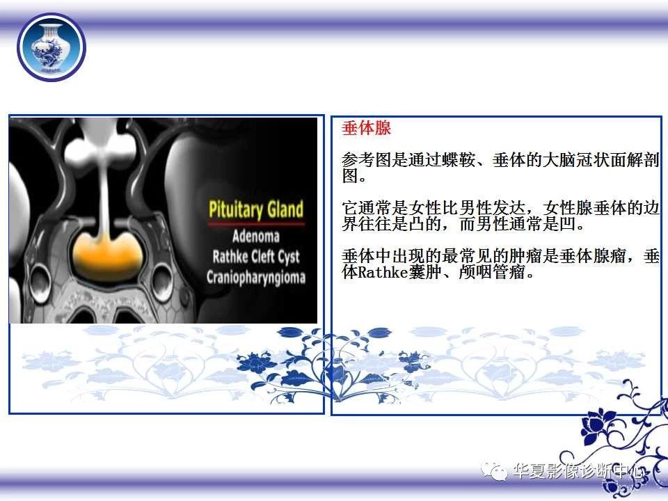 b956d2150bcac32e4ee21da904991be1.jpg