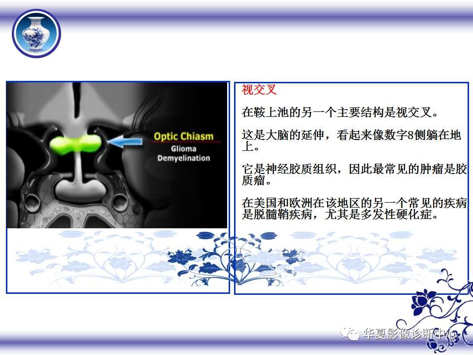 bd2787ca024c126bf41e82e404b67411.jpg