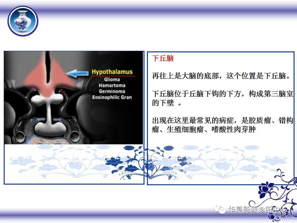 c47d4c29e45bf274d04416310c52cca9.jpg