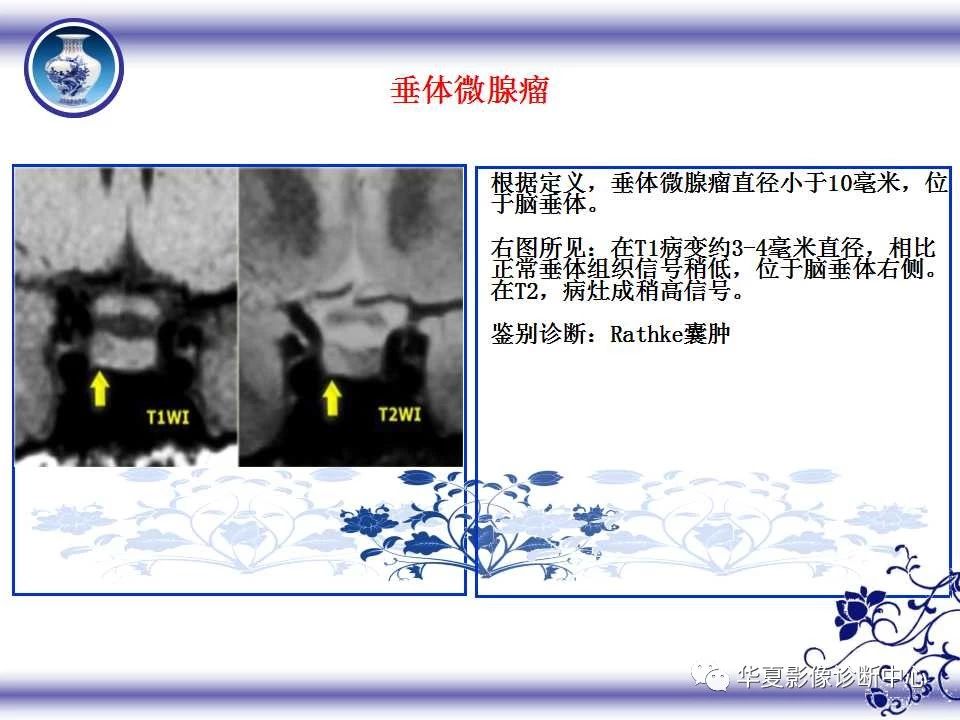 c628bbb33d0841da1c103ff1cf10b20b.jpg
