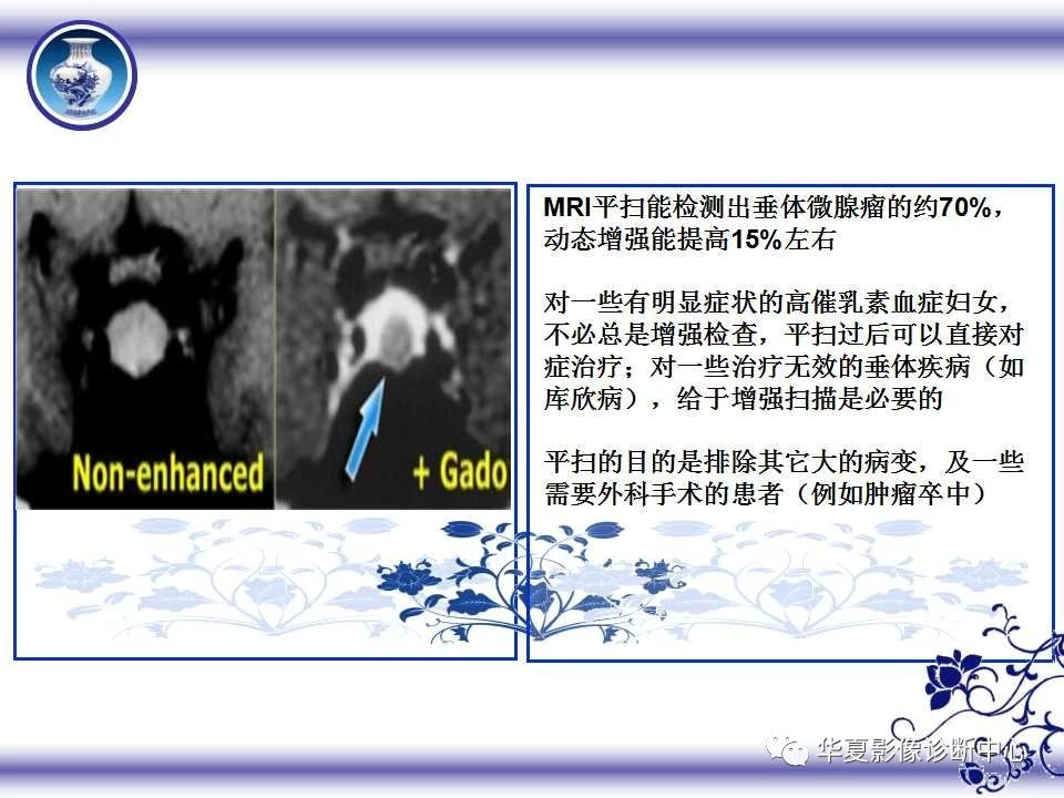 321cdce82b170bfeafb06d38c1c9ae29.jpg