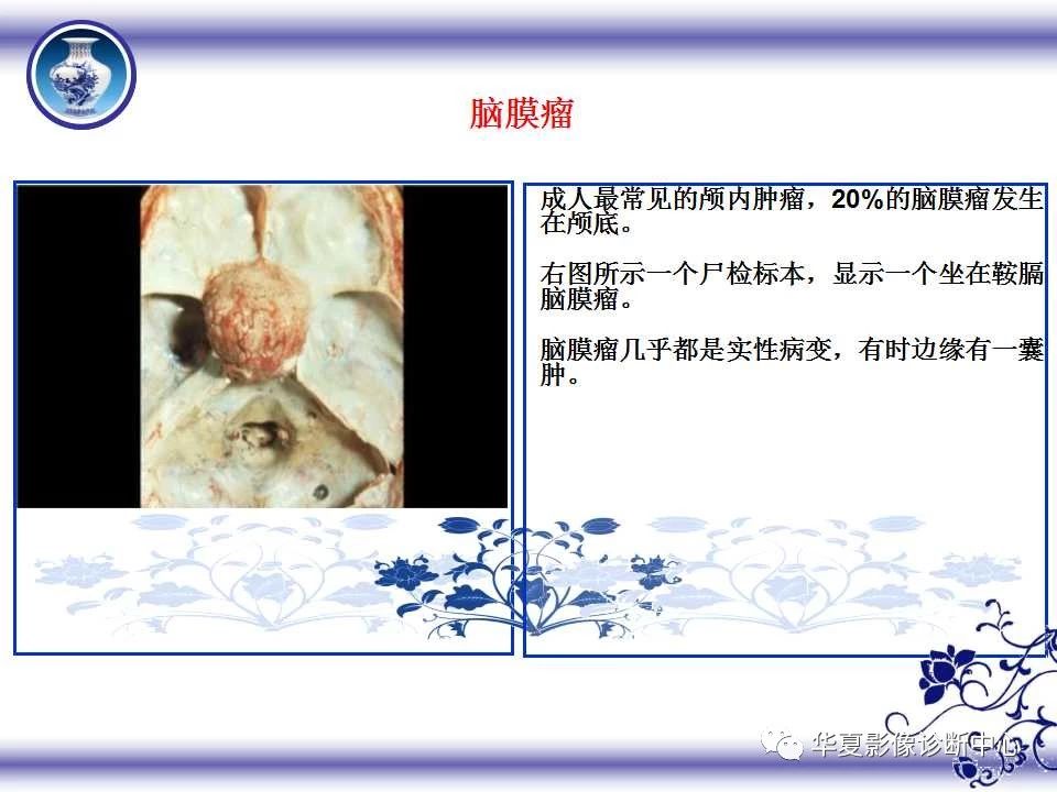 c39512c10eeb0699bcc0a43ec2a699e1.jpg