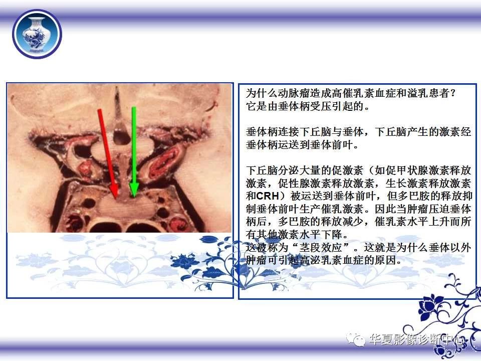 d5688e7fc87063bc51df305b7b9a9b0e.jpg