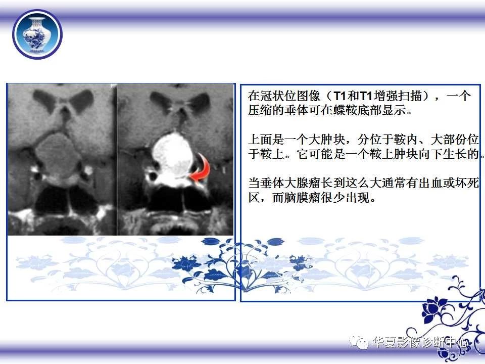 d29356b4b7d8fb109e5705fa5d892685.jpg