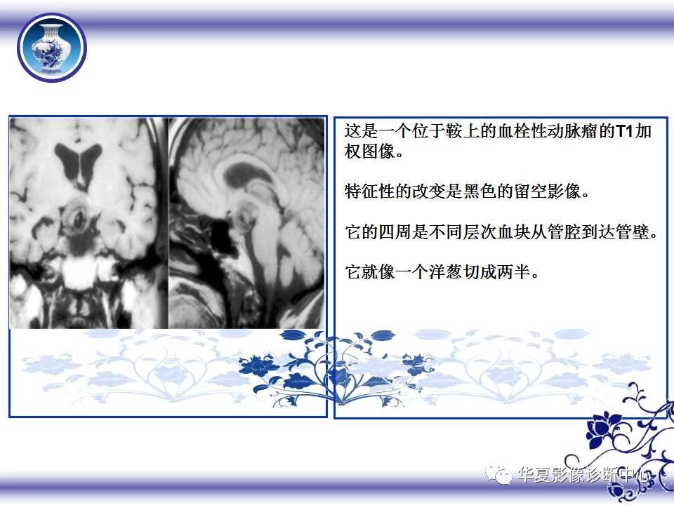 3c053aefd510b98eb3db4aee100fdbb6.jpg