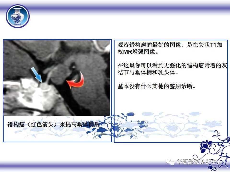11c0b49ff280457f9b9266dcea059980.jpg
