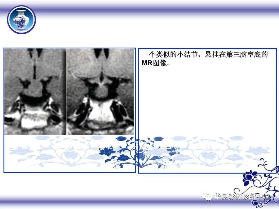 a7bef63116cc12944ea40809f691717b.jpg