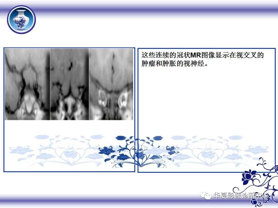 93307f4da587ec5ec975415e6ed5d442.jpg