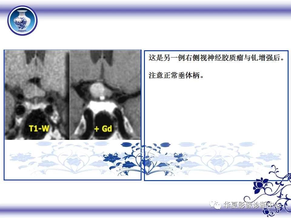 891d468b8b4009cfb9f298e3e04abd86.jpg