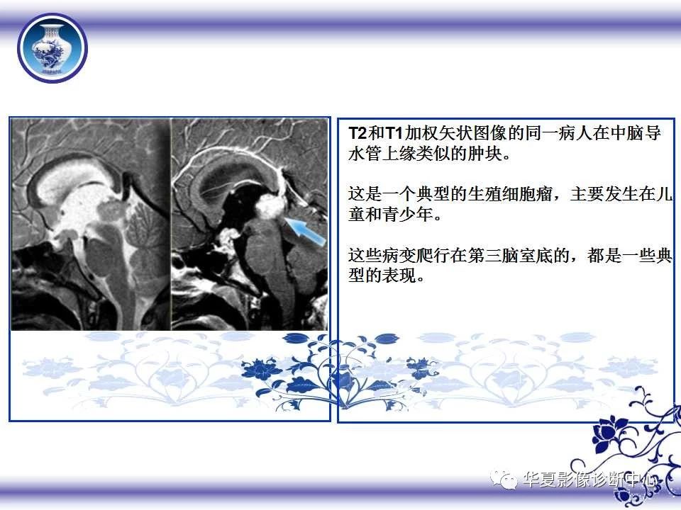 d907bf632c6a6562fe4c5d1e921cf336.jpg