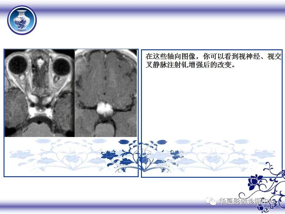 95d83d3d4a70201ff70280bb7c48621d.jpg