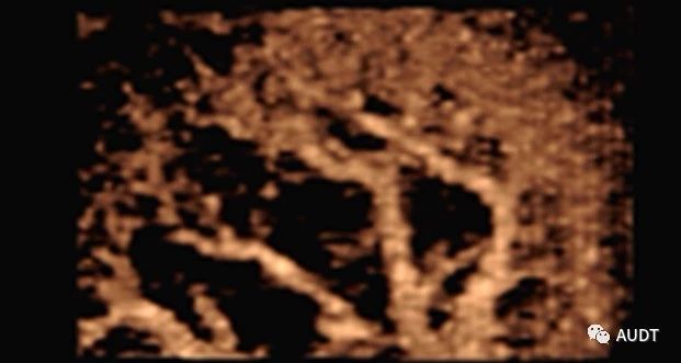 d5f4723546e5226036a9cce4654e2ee9.jpg