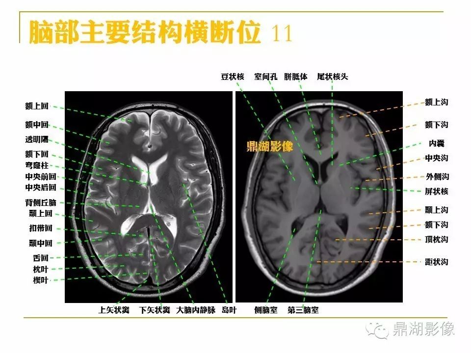 a2f17b865640c41bf474e5712de16fef.jpg