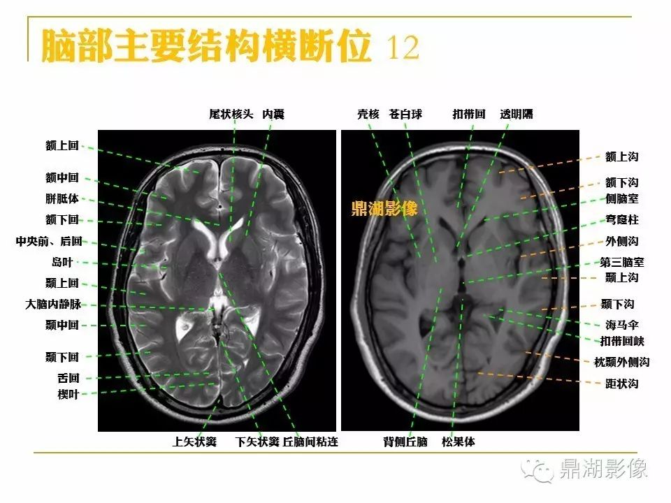 3321b750d3473b3ee5931db91125e116.jpg