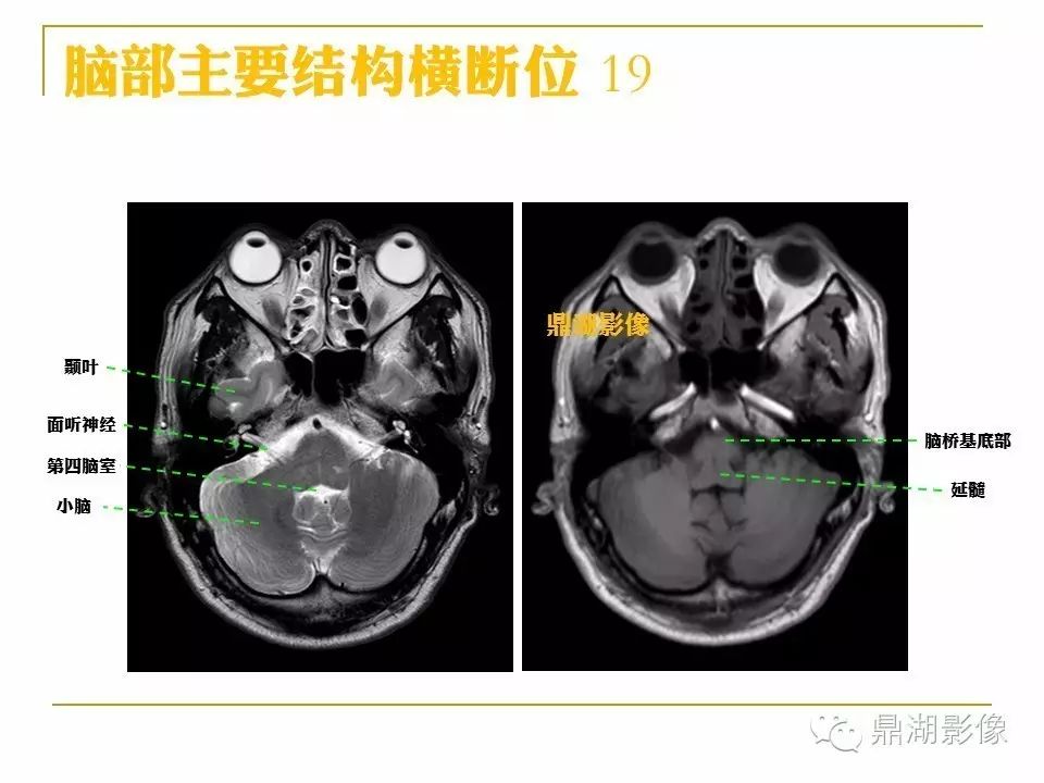 d0faa1425719e51cc9f5dd4c31357f70.jpg