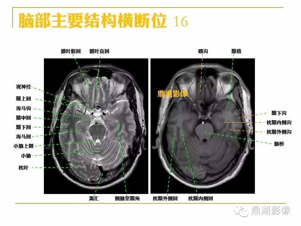 bc6319a90fa552d03b9d5e12b0855a61.jpg