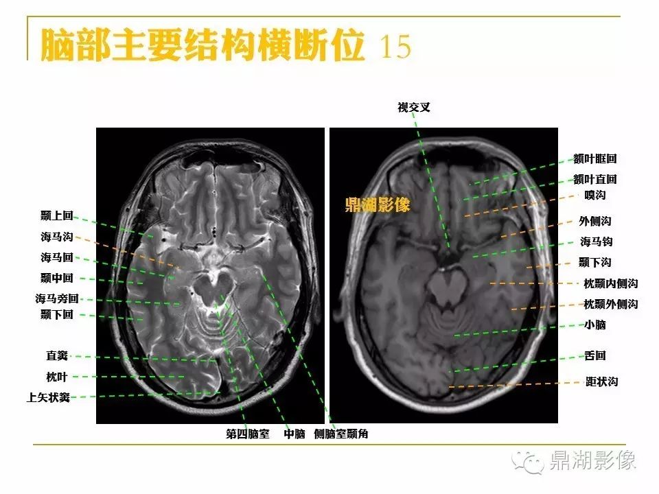 e36b61ef3663cd37f962ab7aab8dc6a7.jpg
