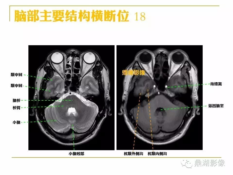 b0cc871ebfaf9ae451072a5de21d8d93.jpg