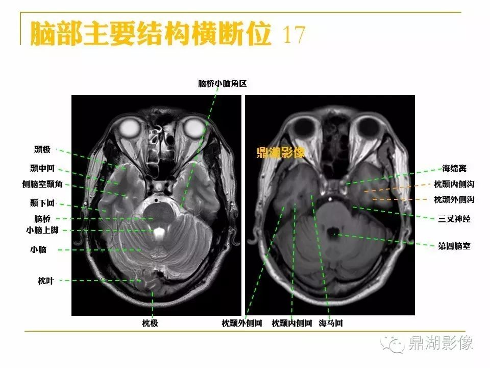 26d95db2fc6f16aefeedf59897b7e56b.jpg