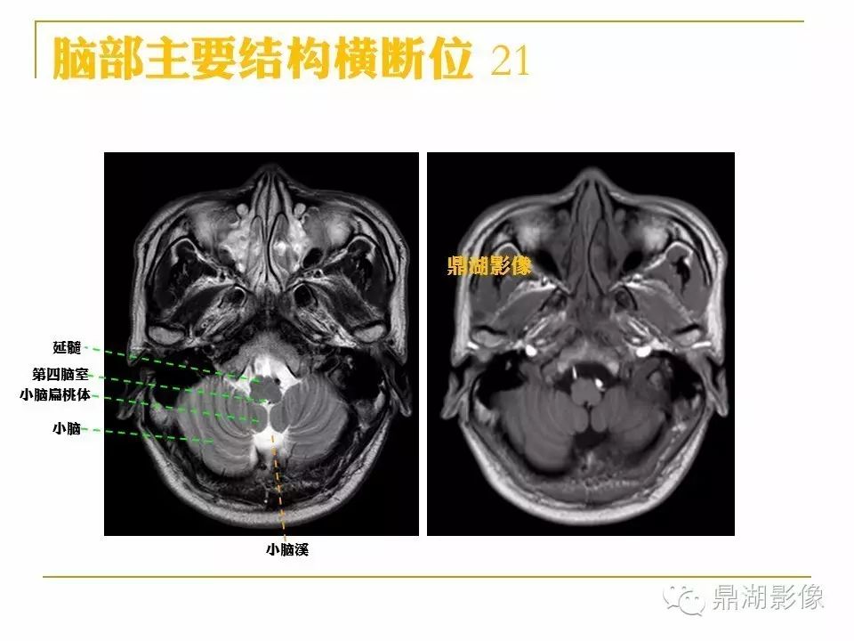 5ce4e9ad46d0218289140a92ff1be081.jpg