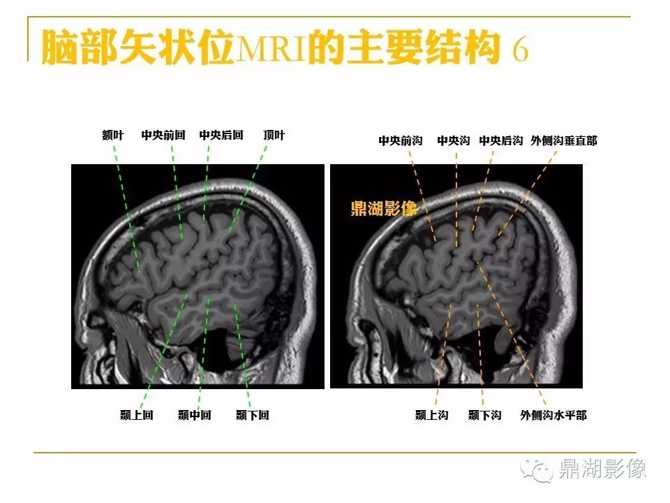 ce35d1d513b636a88774d1965514eceb.jpg
