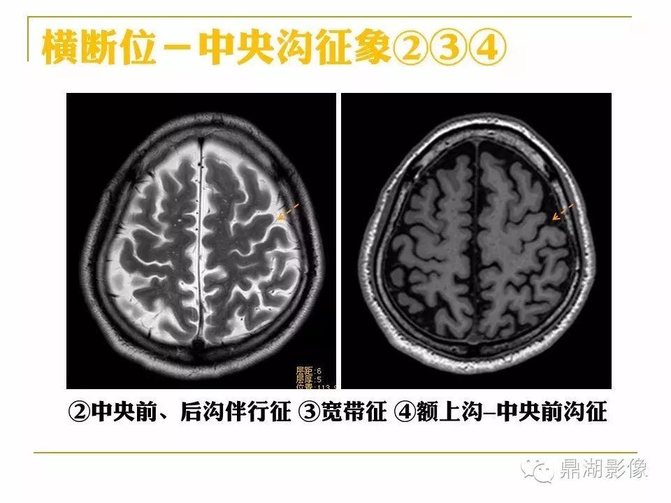 f4d2894280cd420a493f8f1e3802e9a8.jpg