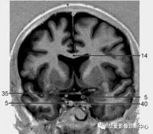 df866f9c0a255c4bec579f798508ee19.jpg