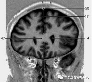 4cd676e7bb18020cf63eac5a5e3f8569.jpg