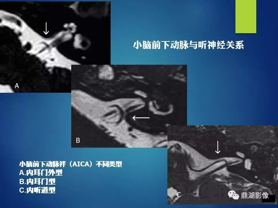 057b971a57ecc989d3fda34fba2fc083.jpg
