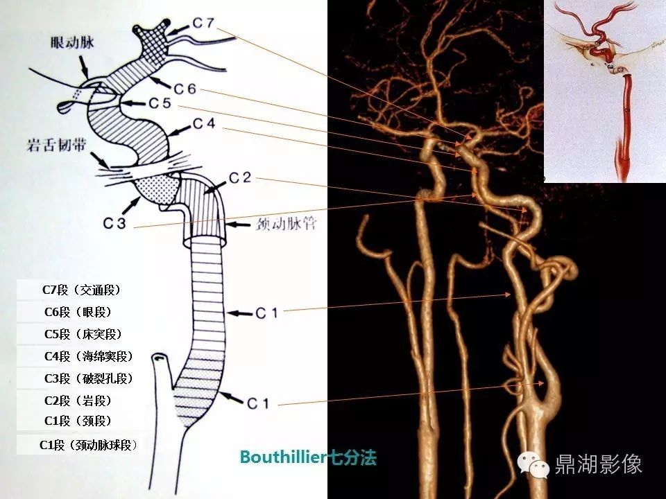 9cddcd2dc237d15e6d8bfc0a73dab1cb.jpg