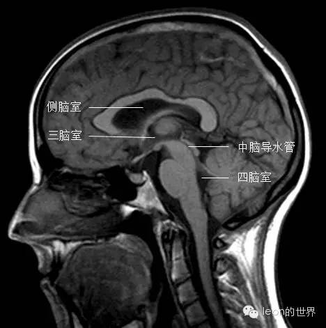 4a418ae1070325e7d602cbd88f0842d9.jpg
