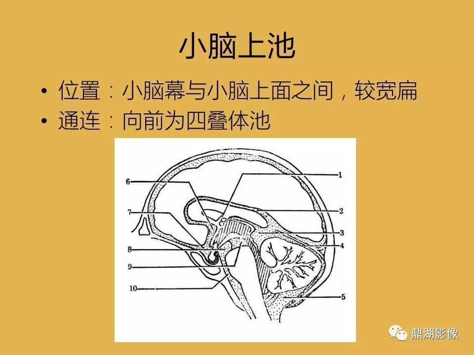 336cd7da1967d4a460845ebc13a6a539.jpg