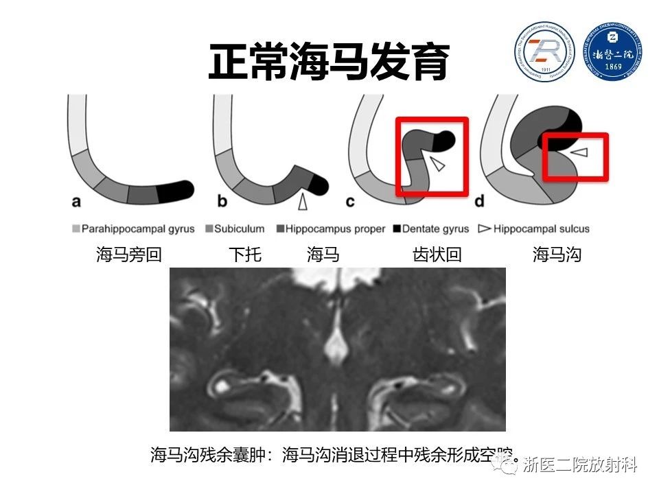 a93b4735a06c35aee237f756e1c64f04.jpg