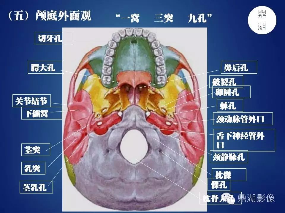 a8897b1ab67b1a9ed85cb200aa7666d4.jpg