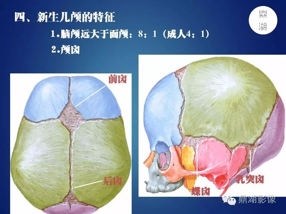 87ba78a2b96155dd80e153ea40fa8009.jpg