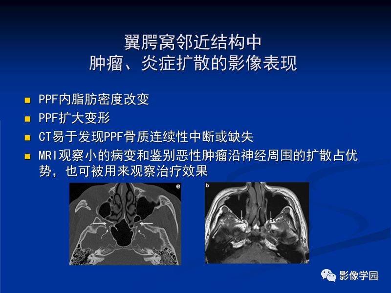 922ab4bef9008d7d73b5e19d808790ac.jpg