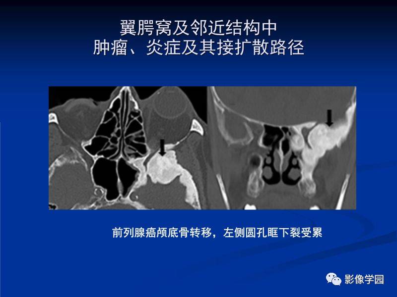 53dd172b0dc535a08bf8429a4da411d3.jpg
