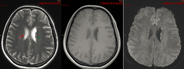qw6.jpg
