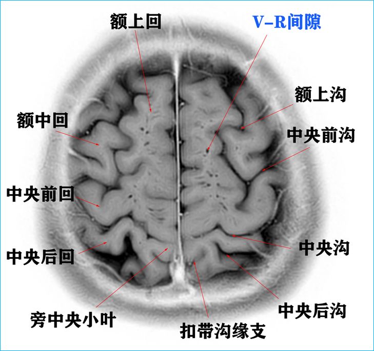 qw6.jpg