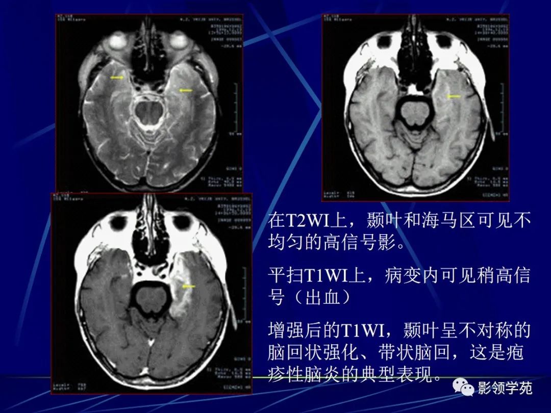 qw45.jpg