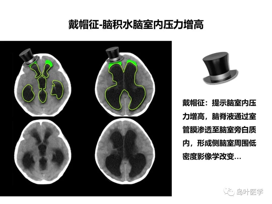 qw38.jpg